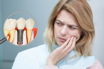 Do Dental Implants Hurt: Myths vs Reality Explained by Dentists